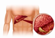 Julho Amarelo: Saiba como identificar as hepatites virais