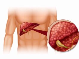 Julho Amarelo: Saiba como identificar as hepatites virais